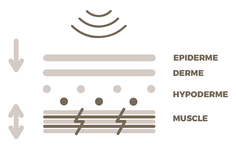 Effets de l'lectrostimulation sur la peau